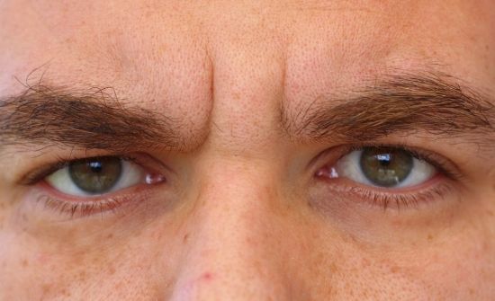 INJERTO DE CEJAS Salud & Vida - Injerto Capilar